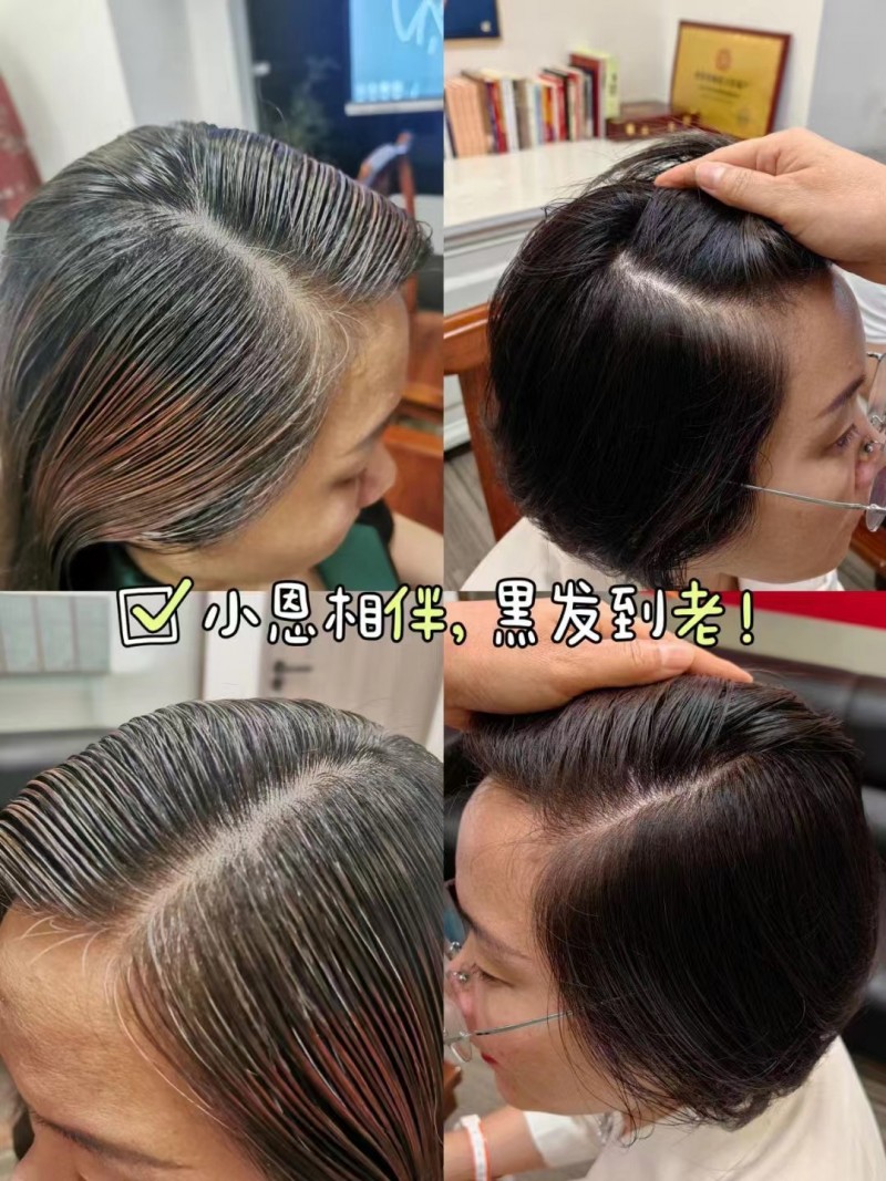 《影响力人物》栏目:重塑秀发青春 再现人生华彩